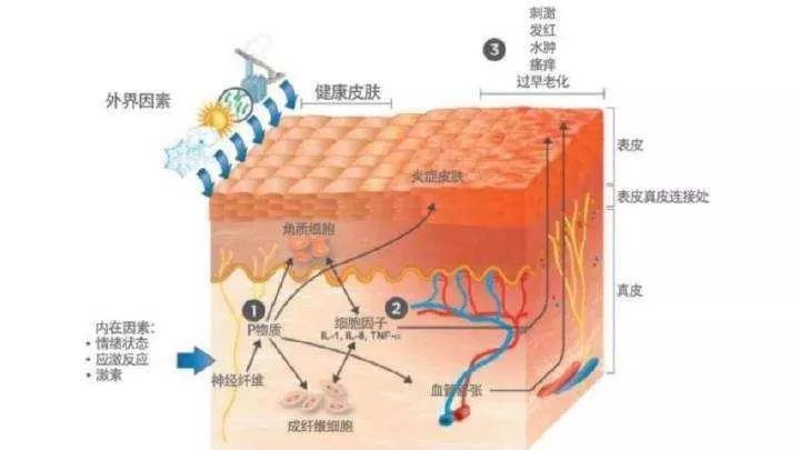 寶雞市“屏障修復(fù)”修復(fù)的是什么？不同膚質(zhì)該如何搭配？